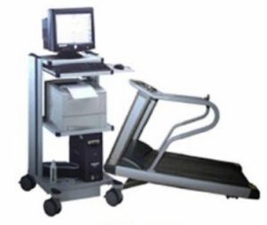 TREADMILL STRESS ECG
