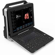 ULTRASOUND SCANNER 5D COLOR DOPPLER AM-K5