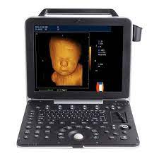 ULTRASOUND SCANNER 5D COLOR DOPPLER AM-K6